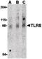 Toll Like Receptor 5 antibody, LS-B601, Lifespan Biosciences, Western Blot image 