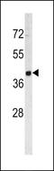 Tumor Associated Calcium Signal Transducer 2 antibody, LS-C98418, Lifespan Biosciences, Western Blot image 