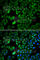 Protein Arginine Methyltransferase 5 antibody, A1520, ABclonal Technology, Immunofluorescence image 
