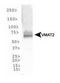 Solute Carrier Family 18 Member A2 antibody, TA309861, Origene, Western Blot image 