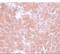 Transmembrane Protein 70 antibody, A06360, Boster Biological Technology, Immunohistochemistry paraffin image 