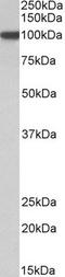 Aryl Hydrocarbon Receptor Nuclear Translocator antibody, TA326733, Origene, Western Blot image 