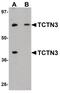 Tectonic Family Member 3 antibody, PA5-20985, Invitrogen Antibodies, Western Blot image 