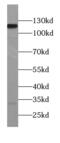 Testis-specific Y-encoded-like protein 2 antibody, FNab01513, FineTest, Western Blot image 