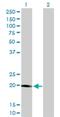 Serine/Threonine Kinase 32A antibody, H00202374-M01, Novus Biologicals, Western Blot image 