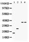 Phospholamban antibody, PB9381, Boster Biological Technology, Western Blot image 