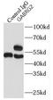 Gamma-Aminobutyric Acid Type A Receptor Gamma2 Subunit antibody, FNab03289, FineTest, Immunoprecipitation image 