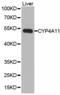 Cytochrome P450 Family 4 Subfamily A Member 11 antibody, abx123453, Abbexa, Western Blot image 