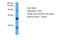 Thiosulfate Sulfurtransferase Like Domain Containing 2 antibody, A15775, Boster Biological Technology, Western Blot image 