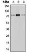 Solute Carrier Family 28 Member 1 antibody, orb214869, Biorbyt, Western Blot image 