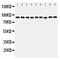Valosin Containing Protein antibody, PA2137, Boster Biological Technology, Western Blot image 