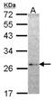 NME/NM23 Family Member 5 antibody, NBP1-32207, Novus Biologicals, Western Blot image 