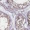 C11orf49 antibody, HPA040280, Atlas Antibodies, Immunohistochemistry frozen image 