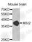 Musashi RNA Binding Protein 2 antibody, A6004, ABclonal Technology, Western Blot image 