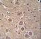Tumor Protein P53 Inducible Nuclear Protein 1 antibody, LS-C160127, Lifespan Biosciences, Immunohistochemistry paraffin image 