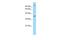 Neuropeptides B And W Receptor 2 antibody, A10246, Boster Biological Technology, Western Blot image 