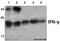 Interferon Gamma antibody, GTX66714, GeneTex, Western Blot image 