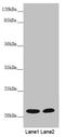 Myosin Light Chain 3 antibody, LS-C676105, Lifespan Biosciences, Western Blot image 