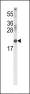 Retinol Binding Protein 2 antibody, LS-C162507, Lifespan Biosciences, Western Blot image 