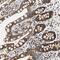 KH Domain Containing 4, Pre-MRNA Splicing Factor antibody, NBP1-86485, Novus Biologicals, Immunohistochemistry paraffin image 