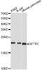 SP-C antibody, A1835, ABclonal Technology, Western Blot image 