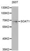 Sterol O-acyltransferase 1 antibody, abx004824, Abbexa, Western Blot image 