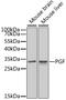 Placental Growth Factor antibody, MBS127199, MyBioSource, Western Blot image 