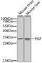 Placental Growth Factor antibody, MBS127199, MyBioSource, Western Blot image 