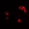 Interleukin-23 receptor antibody, orb378132, Biorbyt, Immunofluorescence image 