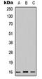 Cystatin SN antibody, LS-B14563, Lifespan Biosciences, Western Blot image 