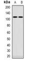 VPS54 Subunit Of GARP Complex antibody, orb382500, Biorbyt, Western Blot image 