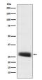 Proopiomelanocortin antibody, M00305-1, Boster Biological Technology, Western Blot image 
