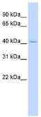 Zinc Finger Protein 174 antibody, TA344455, Origene, Western Blot image 