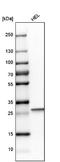 Carbonic Anhydrase 1 antibody, NBP1-88191, Novus Biologicals, Western Blot image 