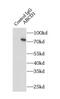 ABCD1 antibody, FNab00035, FineTest, Immunoprecipitation image 