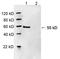 Histone Deacetylase 2 antibody, LS-B13664, Lifespan Biosciences, Western Blot image 
