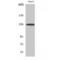 Ephrin type-A receptor 2 antibody, LS-C380694, Lifespan Biosciences, Western Blot image 