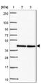 Twinfilin Actin Binding Protein 2 antibody, NBP2-47591, Novus Biologicals, Western Blot image 