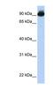 Engulfment And Cell Motility 3 antibody, NBP1-59089, Novus Biologicals, Western Blot image 