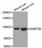 DNA Methyltransferase 3 Beta antibody, STJ23415, St John