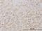 PEAK1 Related, Kinase-Activating Pseudokinase 1 antibody, H00157285-M01, Novus Biologicals, Immunohistochemistry frozen image 