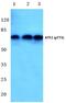 Activating Transcription Factor 2 antibody, PA5-36623, Invitrogen Antibodies, Western Blot image 