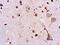 Mucin 1, Cell Surface Associated antibody, NBP2-26672, Novus Biologicals, Immunohistochemistry paraffin image 