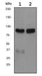 Epsin 1 antibody, ab75879, Abcam, Western Blot image 