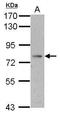 Insulin Like Growth Factor Binding Protein Acid Labile Subunit antibody, GTX102294, GeneTex, Western Blot image 