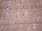 Adiponectin, C1Q And Collagen Domain Containing antibody, LS-C790341, Lifespan Biosciences, Immunohistochemistry paraffin image 
