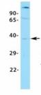 Asialoglycoprotein Receptor 1 antibody, NBP1-54385, Novus Biologicals, Immunohistochemistry frozen image 