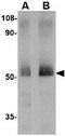 Sprouty Related EVH1 Domain Containing 2 antibody, GTX85025, GeneTex, Western Blot image 