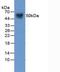 Serpin Family A Member 12 antibody, LS-C296983, Lifespan Biosciences, Western Blot image 