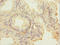 FGF1 Intracellular Binding Protein antibody, LS-C675760, Lifespan Biosciences, Immunohistochemistry paraffin image 